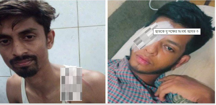 ছাতকে দু’পক্ষের সংঘর্ষ: আহত ৩