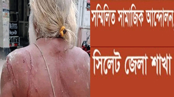 কুঁড়িগ্রামের ঘটনায় সামাজিক আন্দোলনের উদ্বেগ ও ক্ষোভ প্রকাশ