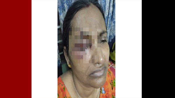 ছাতকে দপ্তরির হামলায় প্রধান শিক্ষক আহত