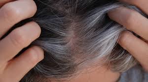 ক্যান্সার রক্ষা করতে পারে পাকা চুল, জেনে নিন কিভাবে