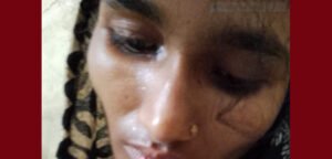 সিলেটে মায়ের হাতে দেড় বছরের শিশুকন্যা খুন