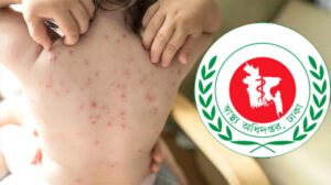 হামে মৃত্যুতে শীর্ষে বাংলাদেশ