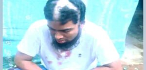 জৈন্তাপুরে কিশোরকে বলাৎকারের অভিযোগে ‘কবিরাজ’ গ্রেপ্তার, মামলা দায়ের